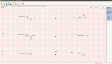 ECG of the dog. Averaged QRS wave from 6 leads