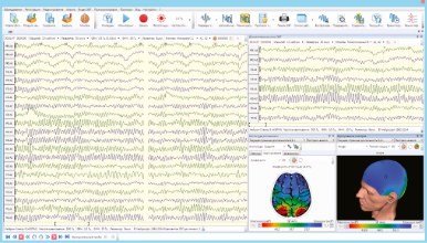 EEG acquisition and analysis