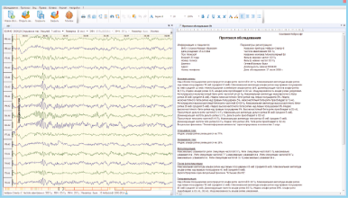 Automatic generation of EEG exam report
