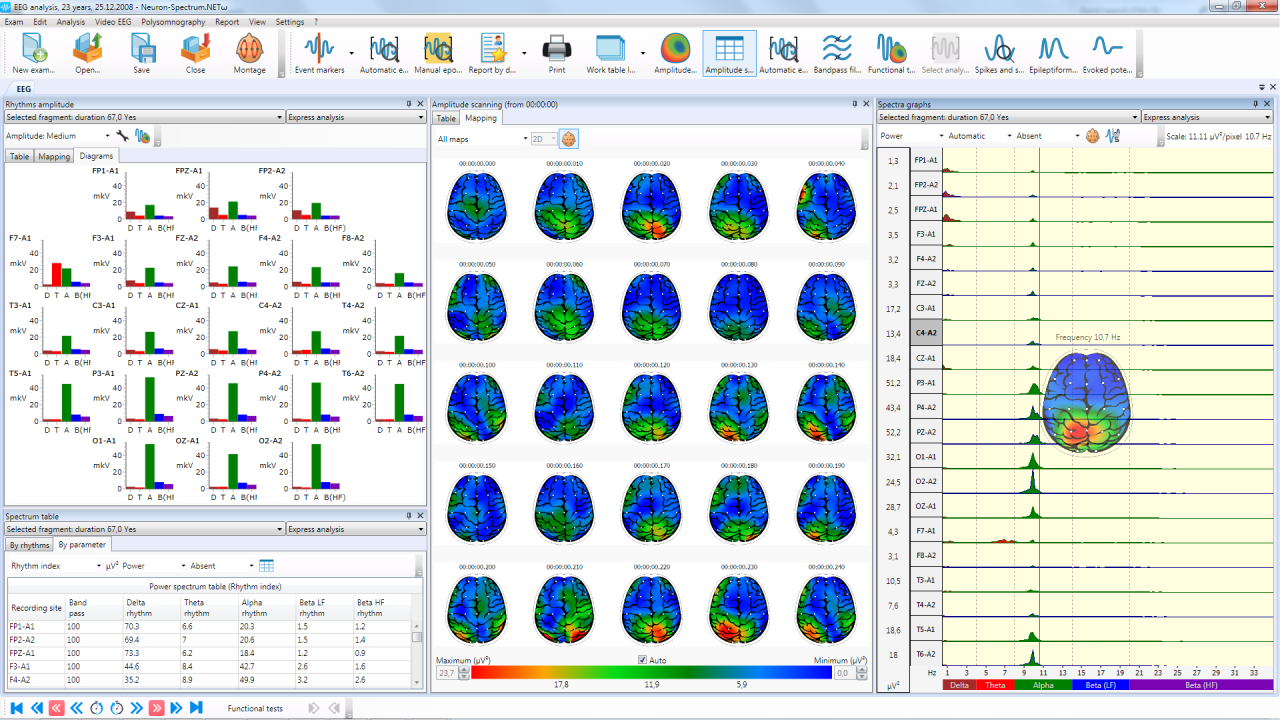 Brain mapping and bar charts </br>of EEG analysis results